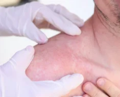 Revolutionizing-Melanoma-Treatment-The-Shocking-Discovery-That-Could-Save-Lives